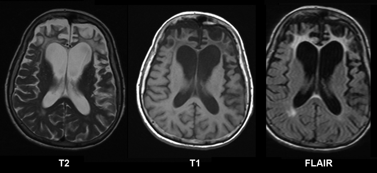 How Neurologists Diagnose Brain Disorders