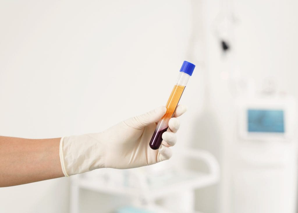 How PRP Injections Promote Healing