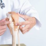 Orthopedic Surgeons and Their Role in Treating Arthritis
