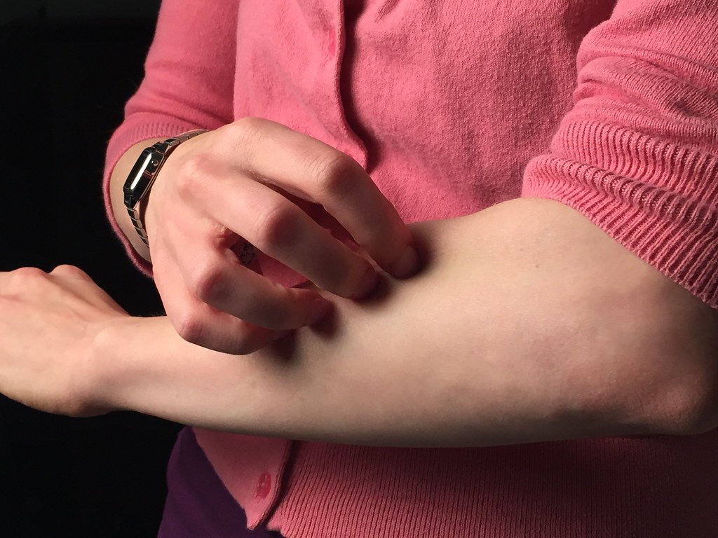 The Connection Between Allergies and Skin Conditions