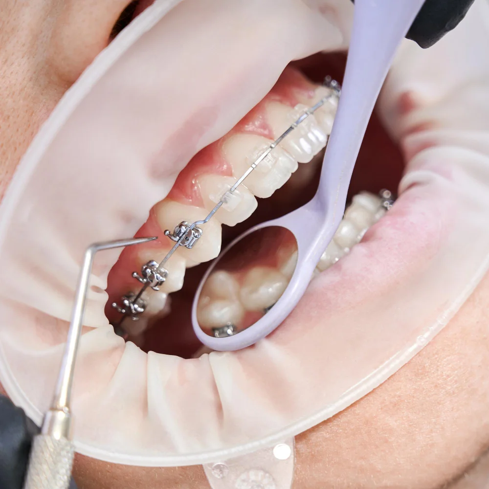 The Importance of Regular Visits to a Periodontist for Gum Care