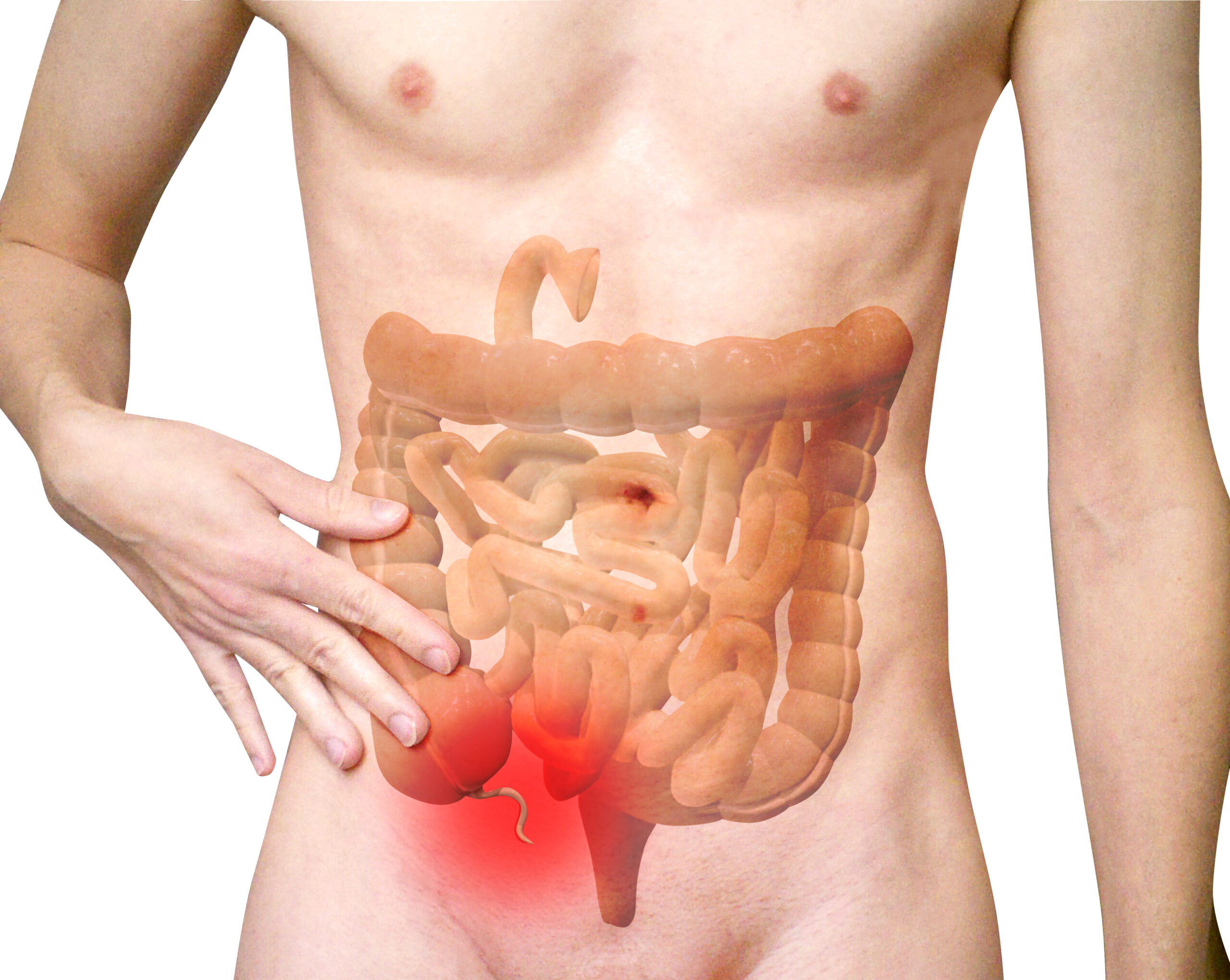 The Role of Gastroenterology in Diagnosing IBS