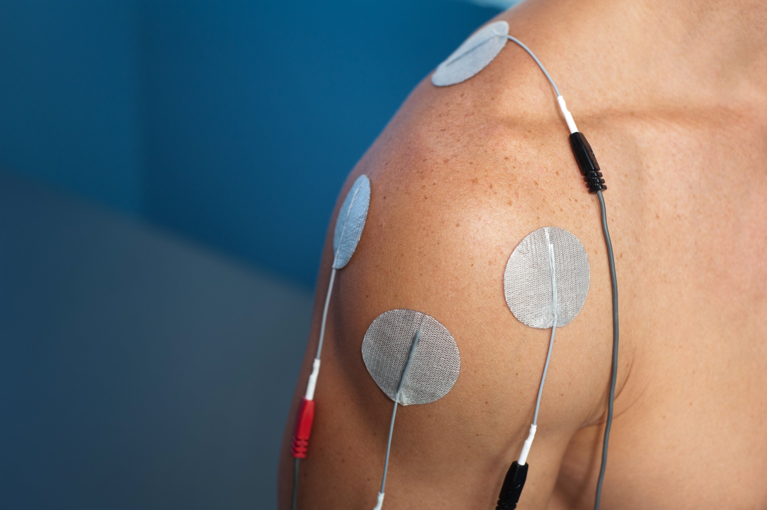 Why Spinal Cord Stimulation Could Be the Key to Chronic Pain Relief