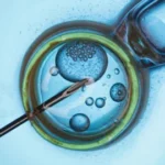 How to Prepare for a Vasectomy: Essential Tips