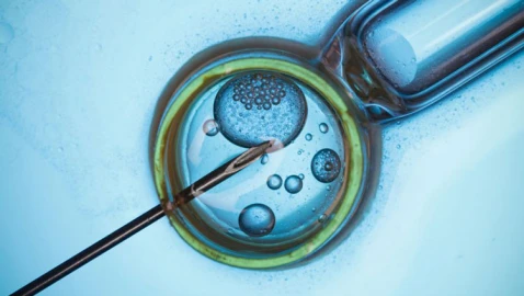 How to Prepare for a Vasectomy: Essential Tips