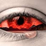 What Are the Most Common Causes of Red Eyes?