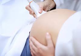 Common Questions About Ultrasounds