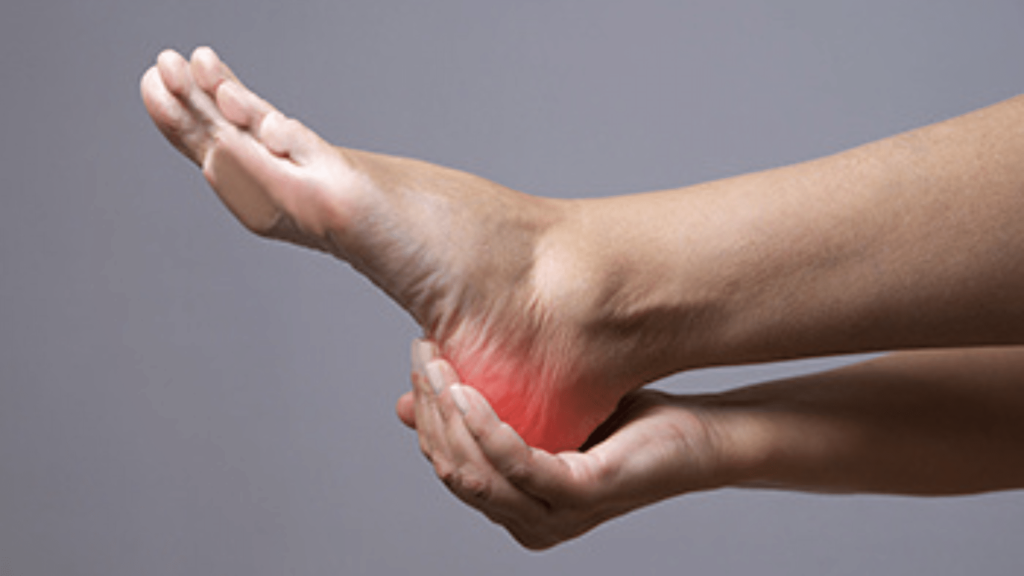 3 Causes of Plantar Fasciitis
