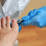 4 Services Offered by Podiatry Clinics
