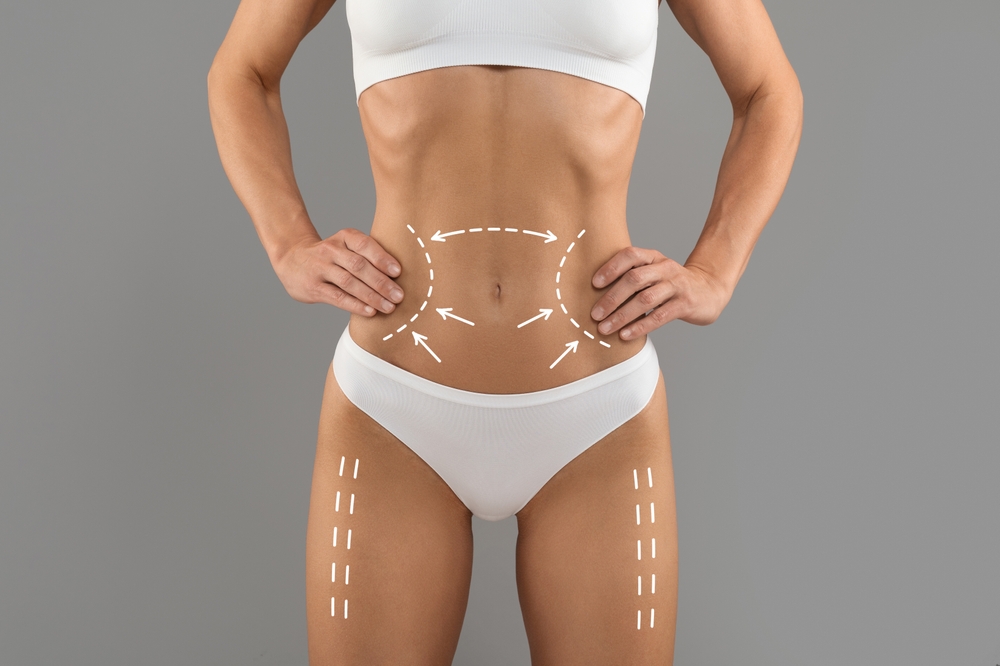 Exploring the Benefits of EMSculpt for Body Contouring