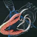 Finding the Right Cardiologist for Your Needs