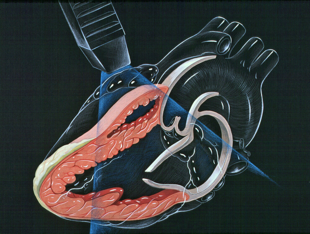 Finding the Right Cardiologist for Your Needs