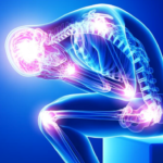 How Neurologists Manage Chronic Pain and Neuropathy