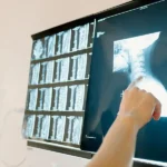 How Orthopedic Surgeons Diagnose Common Sports Injuries
