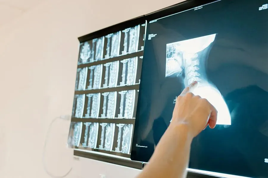 How Orthopedic Surgeons Diagnose Common Sports Injuries