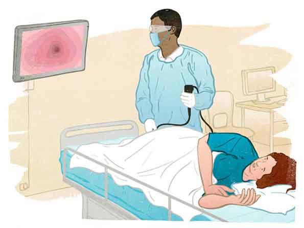 The Role of Regular Colon Cancer Screening in Early Detection