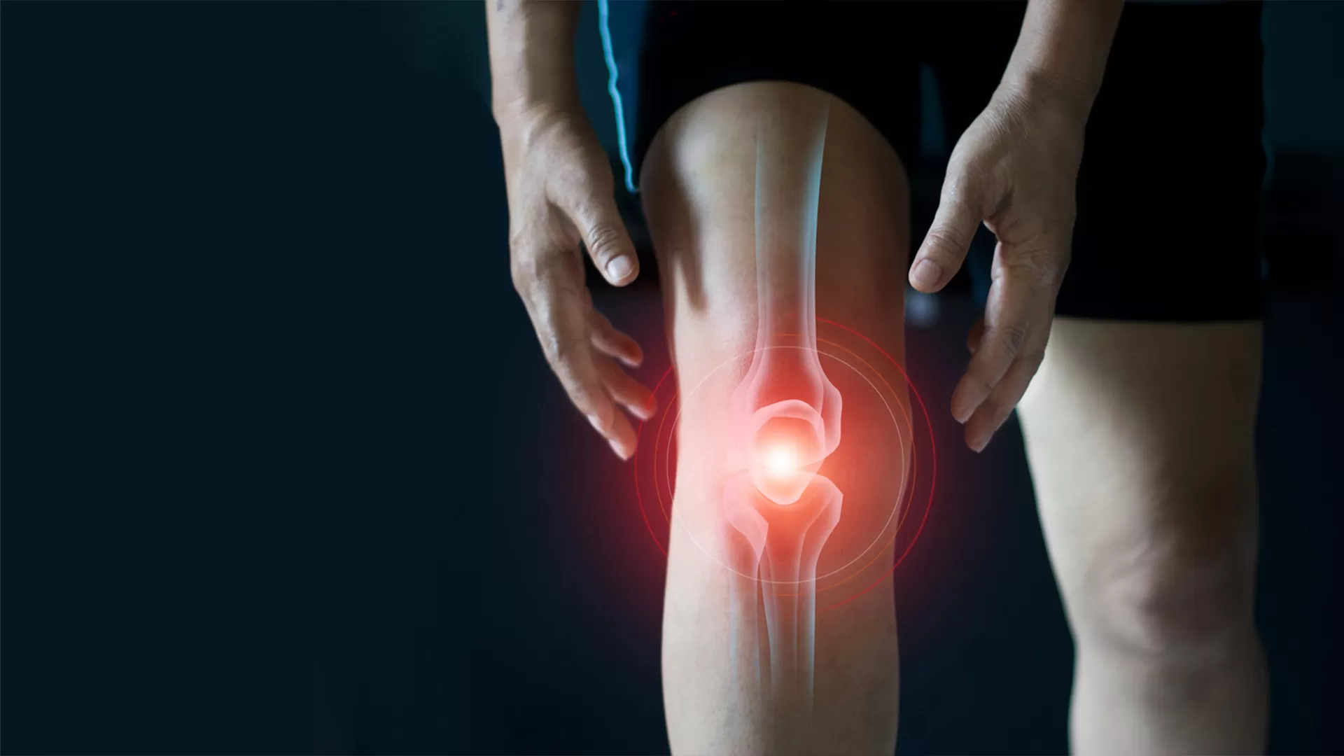 Understanding Joint Replacement Surgery