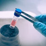 Understanding the Benefits and Risks of Stem Cell Therapy