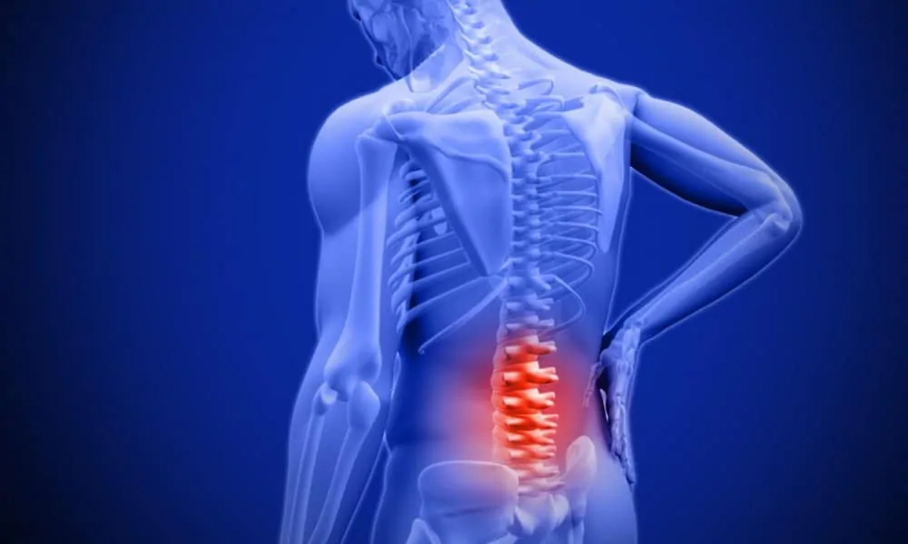 What Causes Back Pain?