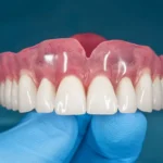 What to Expect When Fitting and Wearing Dentures