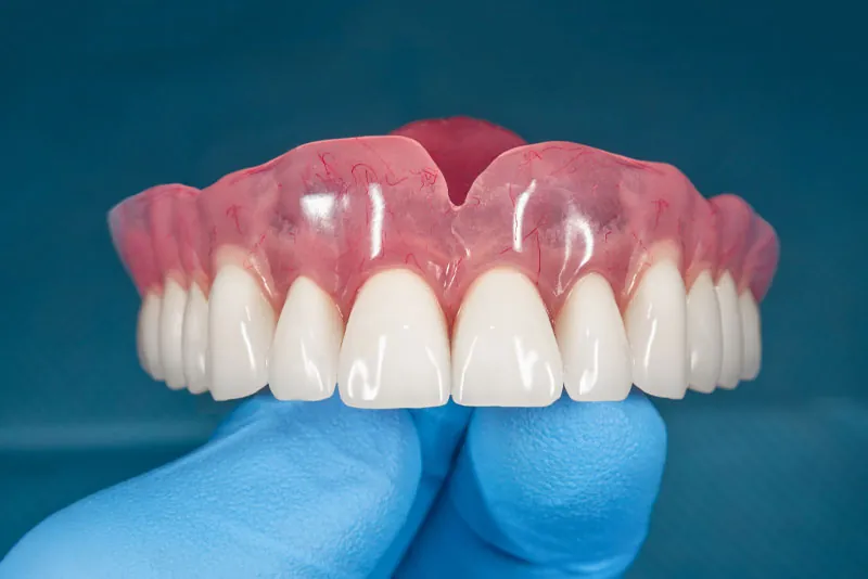 What to Expect When Fitting and Wearing Dentures