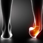 When To Consult a Podiatrist for Foot and Ankle Injuries