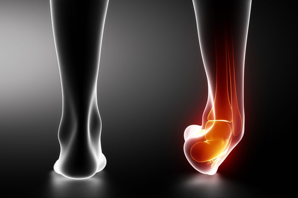 When To Consult a Podiatrist for Foot and Ankle Injuries
